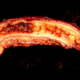 Image for article titled The appendix might actually be the body's bacteria storehouse